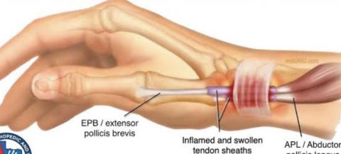 Wrist pain